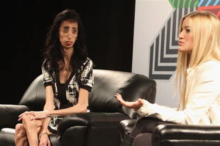 Congrats Girl!Dubbed “The World’s Ugliest Woman” — Lizzie Velasquez Proves Her Haters Wrong By Releasing A Documentary!