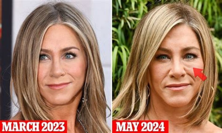 Does Jennifer Aniston have hooded eyes?