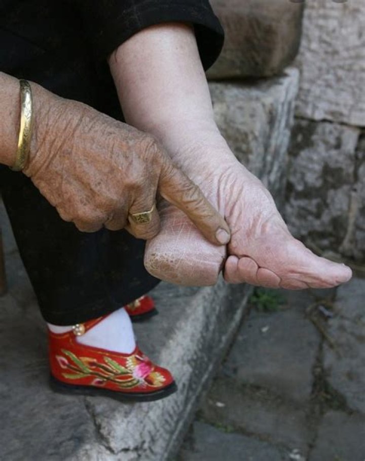 Inside The Disturbing Practice Of Chinese Foot Binding