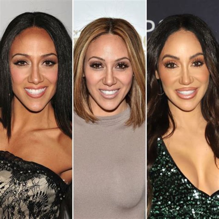 ‘RHONJ’ Star Melissa Gorga Has Undergone Multiple Plastic Surgery Procedures: See Before, After Pics