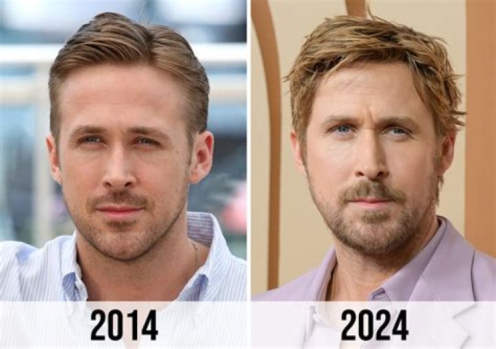 Ryan Gosling Has Faced Baseless Plastic Surgery Rumors for Years: See His Transformation