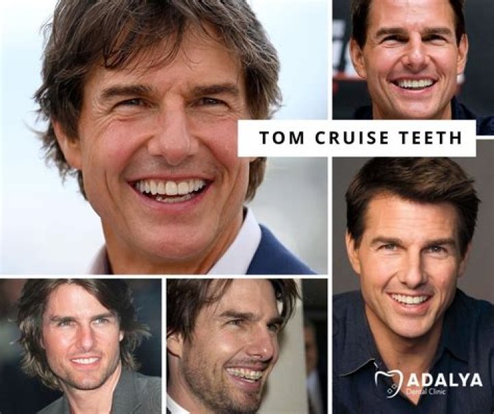 What disease does Tom Cruise have? – Celebrity.fm – #1 Official Stars, Business & People Network, Wiki, Success story, Biography & Quotes
